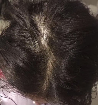 Before image